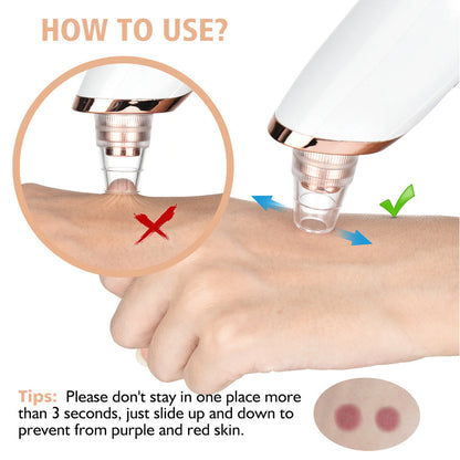 Blackhead Remover Vacuum machine